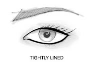 Tightly Lined Tightly Lined